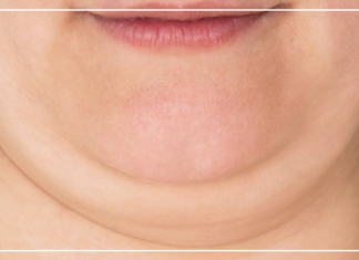 فستاني الملون ضحية التنمر