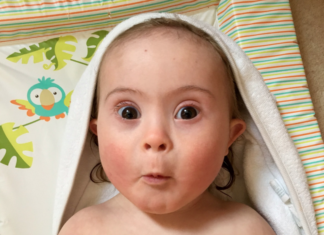 عن ذوي متلازمة داون (3).. منطقة القدرات المختلفة