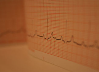 الموت والصدمة والاشتياق الموت